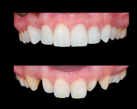 Digital Smile Design Mysore